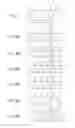 Fig. 05 - Liquid ejecting head and liquid ejecting apparatus