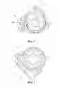 Fig. 05 - LENS MODULE AND METHOD FOR MANUFACTURING LENS MODULE