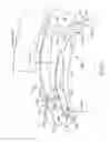 Fig. 06 - Eye covering and refractive correction methods and apparatus having improved tear flow, comfort, and/or applicability