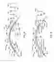 Fig. 22 - Eye covering and refractive correction methods and apparatus having improved tear flow, comfort, and/or applicability
