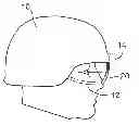 Fig. 01 - Head mounted display