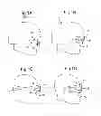 Fig. 02 - Head mounted display