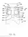Fig. 06 - Damped dual stage actuation disk drive suspensions