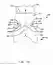 Fig. 07 - Damped dual stage actuation disk drive suspensions