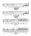Fig. 07 - Methods and apparatus having borehole seismic waveform compression