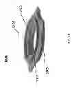 Fig. 11 - WATCH WITH ENCLOSED CROWN