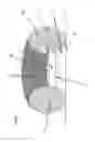 Fig. 08 - Headset apparatus registering movement in the housing