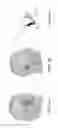 Fig. 05 - Audio headset accommodating ear geometry variations
