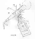 Fig. 27 - Locating and relocating device
