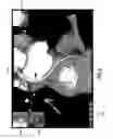 Fig. 09 - Image display of a centerline of tubular structure