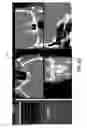 Fig. 12 - Image display of a centerline of tubular structure