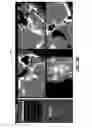 Fig. 13 - Image display of a centerline of tubular structure