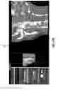 Fig. 14 - Image display of a centerline of tubular structure