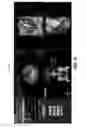 Fig. 16 - Image display of a centerline of tubular structure