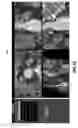 Fig. 17 - Image display of a centerline of tubular structure