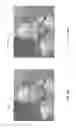 Fig. 09 - Methods of image fusion for image stabilization