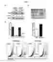 Fig. 04 - Methods for suppressing cancer by inhibition of TMCC3