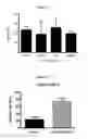 Fig. 29 - Methods for suppressing cancer by inhibition of TMCC3
