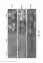Fig. 14 - PROCASPASE 8-MEDIATED DISEASE TARGETING