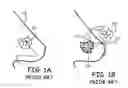 Fig. 02 - Implants and biodegradable fiducial markers