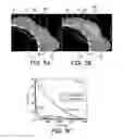 Fig. 06 - Implants and biodegradable fiducial markers