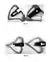 Fig. 11 - OSTEOINDUCTIVE COATINGS FOR DENTAL IMPLANTS