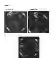Fig. 28 - METHOD FOR TREATMENT OF DISORDERS OF THE GASTROINTESTINAL SYSTEM