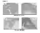 Fig. 49 - METHOD FOR TREATMENT OF DISORDERS OF THE GASTROINTESTINAL SYSTEM