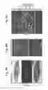 Fig. 17 - METHOD FOR OBTAINING MAB-LIKE CELLS AND USES THEREOF