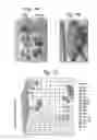 Fig. 20 - METHOD FOR OBTAINING MAB-LIKE CELLS AND USES THEREOF