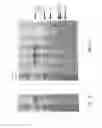 Fig. 04 - Compositions and methods comprising glycyl-tRNA synthetases having non-canonical biological activities