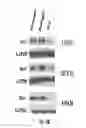 Fig. 31 - Binding molecules specific for HER3 and uses thereof