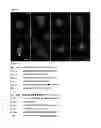 Fig. 17 - BINDING AGENTS TO INTRACELLULAR TARGET MOLECULES