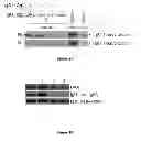 Fig. 02 - Diagnosing and treating IGA nephropathy