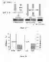 Fig. 03 - Diagnosing and treating IGA nephropathy