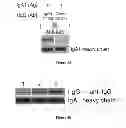Fig. 06 - Diagnosing and treating IGA nephropathy