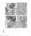 Fig. 22 - Methods for Increasing Efficacy of FOLR1 Cancer Therapy