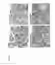 Fig. 23 - Methods for Increasing Efficacy of FOLR1 Cancer Therapy