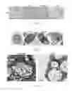 Fig. 04 - METHOD OF INDUCING AUTOPHAGY AND ACTIVATING TOLL-LIKE RECEPTOR