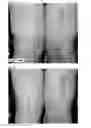 Fig. 04 - METHODS FOR REDUCING OR ALTERING SCAR FORMATION