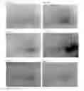 Fig. 06 - METHODS FOR REDUCING OR ALTERING SCAR FORMATION