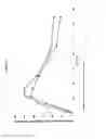 Fig. 05 - TRANSDERMAL DELIVERY SYSTEM COMPRISING BUPRENORPHINE