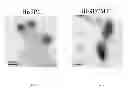 Fig. 05 - Oligomer-contained nanoparticle complex release system