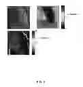 Fig. 06 - Compositions and Methods for Inducing Nanoparticle-mediated Microvascular Embolization of Tumors