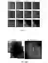 Fig. 22 - Compositions and Methods for Inducing Nanoparticle-mediated Microvascular Embolization of Tumors