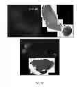 Fig. 24 - Compositions and Methods for Inducing Nanoparticle-mediated Microvascular Embolization of Tumors