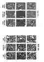 Fig. 26 - Compositions and Methods for Inducing Nanoparticle-mediated Microvascular Embolization of Tumors