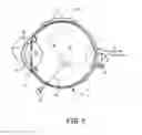 Fig. 05 - Hydrogel polymeric compositions and methods