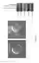 Fig. 07 - Core-shell particle formulation for delivering multiple therapeutic agents