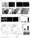 Fig. 06 - Compositions and Methods for Treating and/or Preventing Cancer by Inhibiting Fatty Acid Binding Proteins